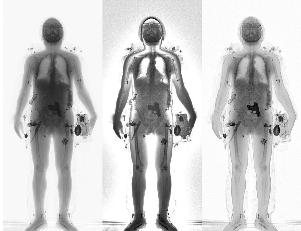 x ray body scanner
